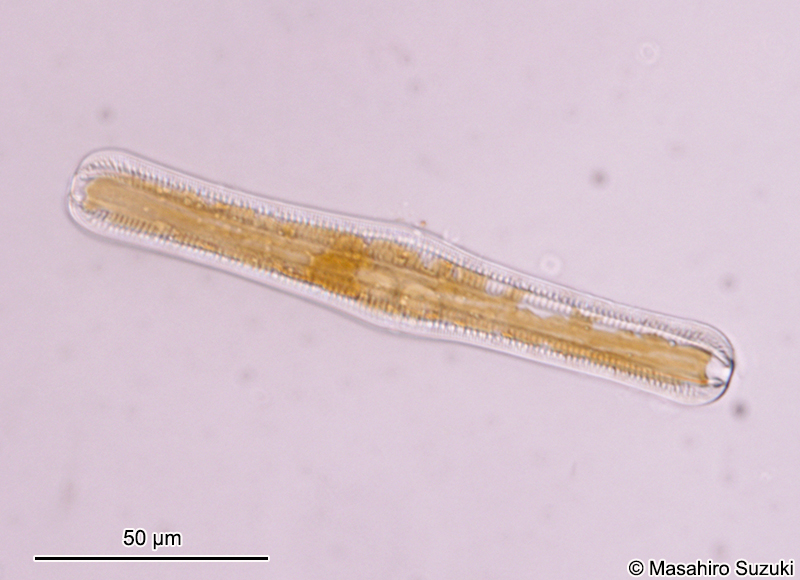 クシガタケイソウ属の1種 Rhopalodia ap.